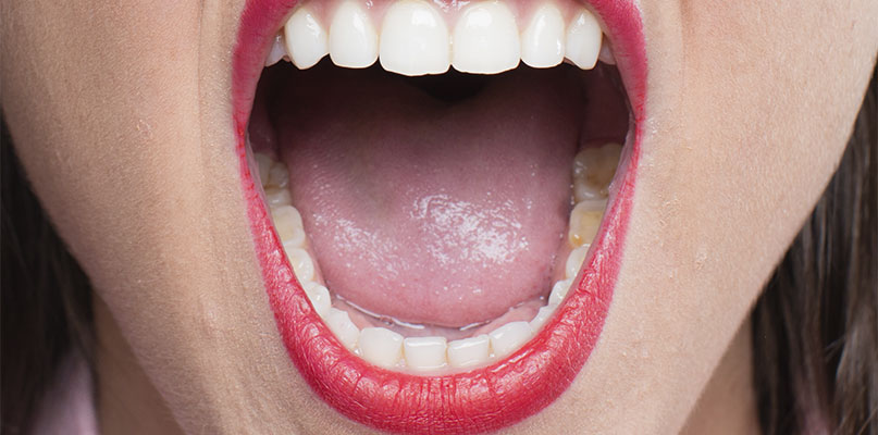 bruno-klaudat-imagem-interna-freio-lingual-e-labial